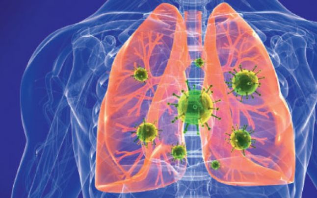 Un pacient japonez este suspect de pneumonie virală care afectează în prezent China