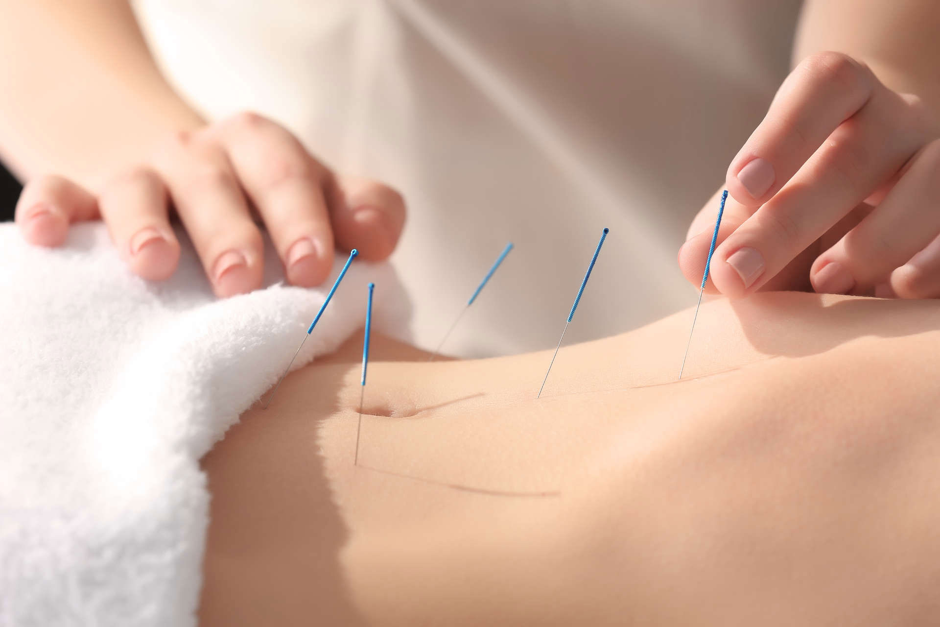 Afectiuni care pot fi tratate cu tratamente acupunctura !