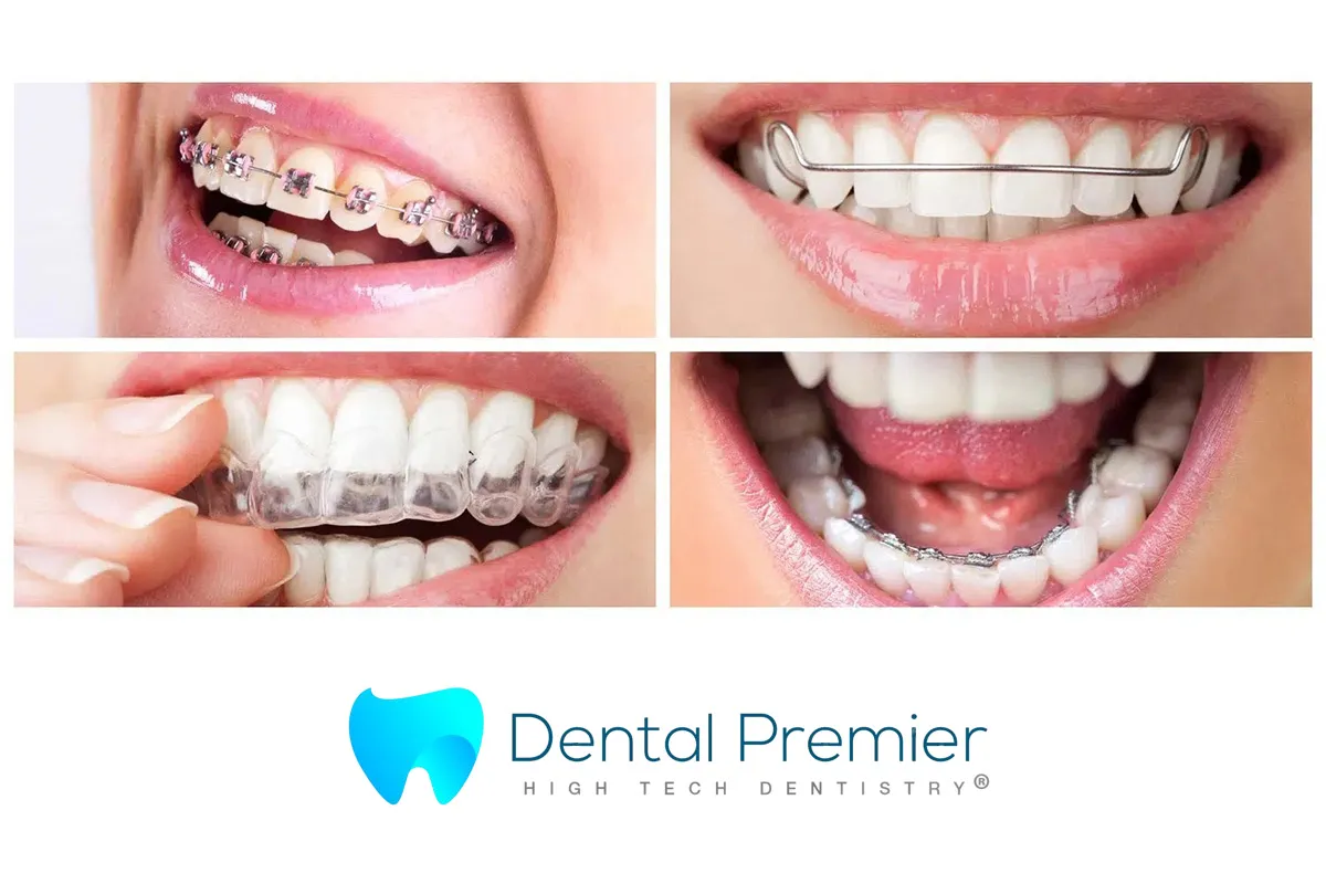 Află prețul unui aparat dentar la Clinica Dental Premier și decide pentru care optezi