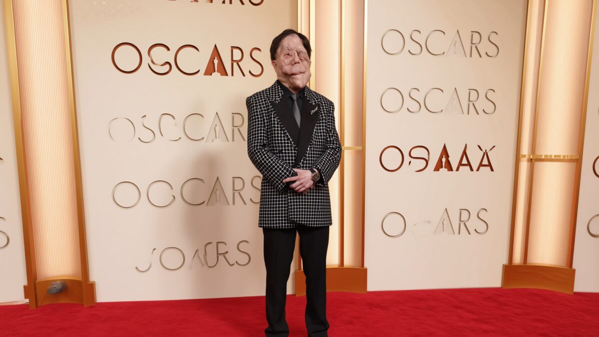 Actorul Adam Pearson, umilit de un comediant. Replica sa a fost vazuta de 3 milioane