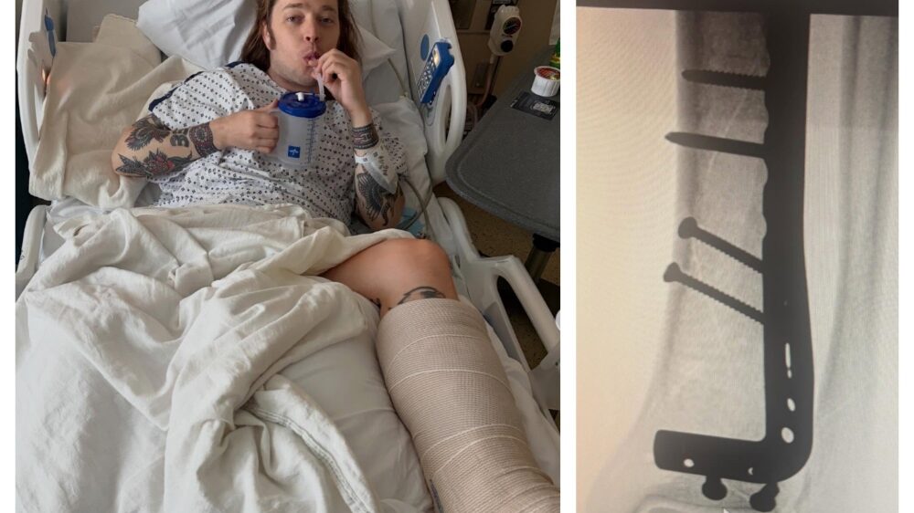 Billy Strings si-a rupt piciorul in doua locuri dupa 29 de piese cantate