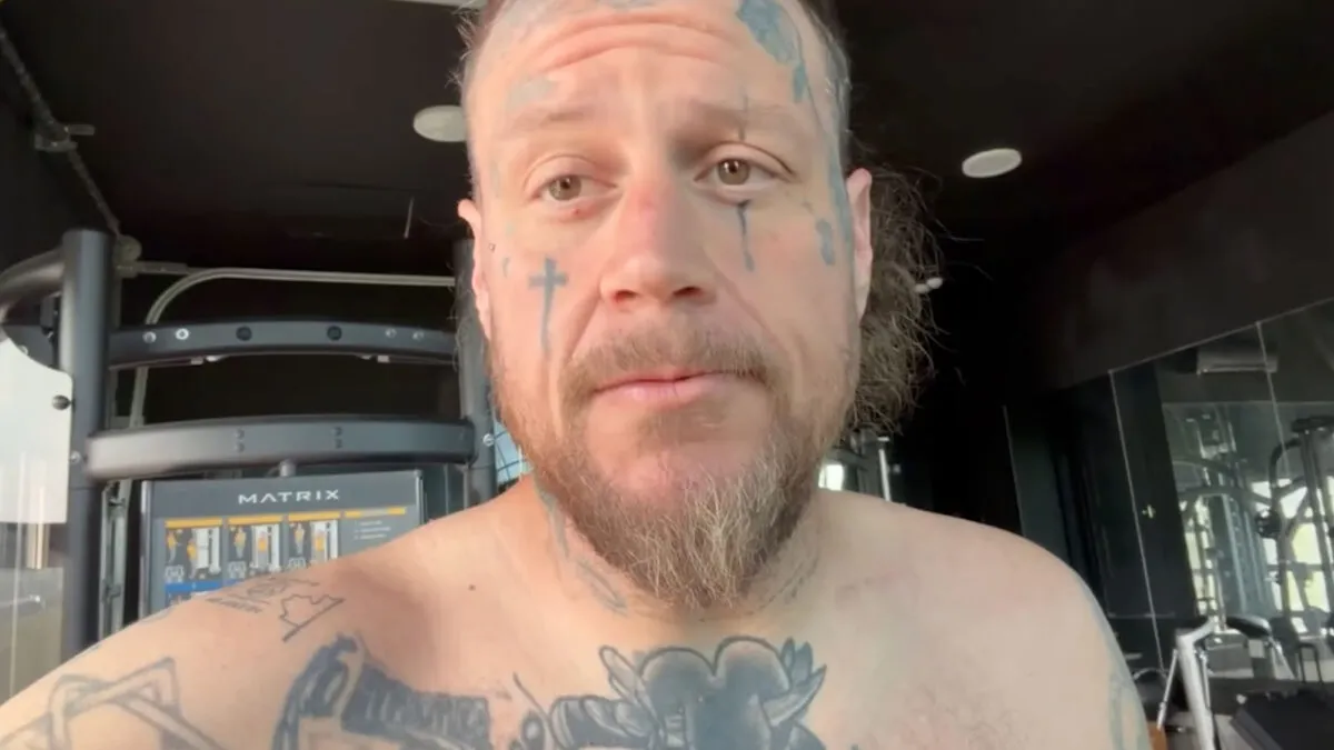Jelly Roll recunoaște că s-a îngrășat 5 kilograme după un accident nefericit